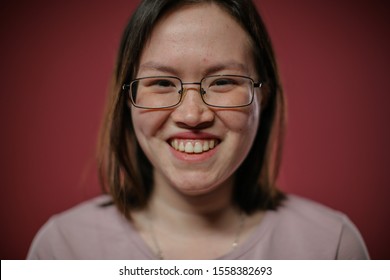 austin revilla add ugly women with glasses photo