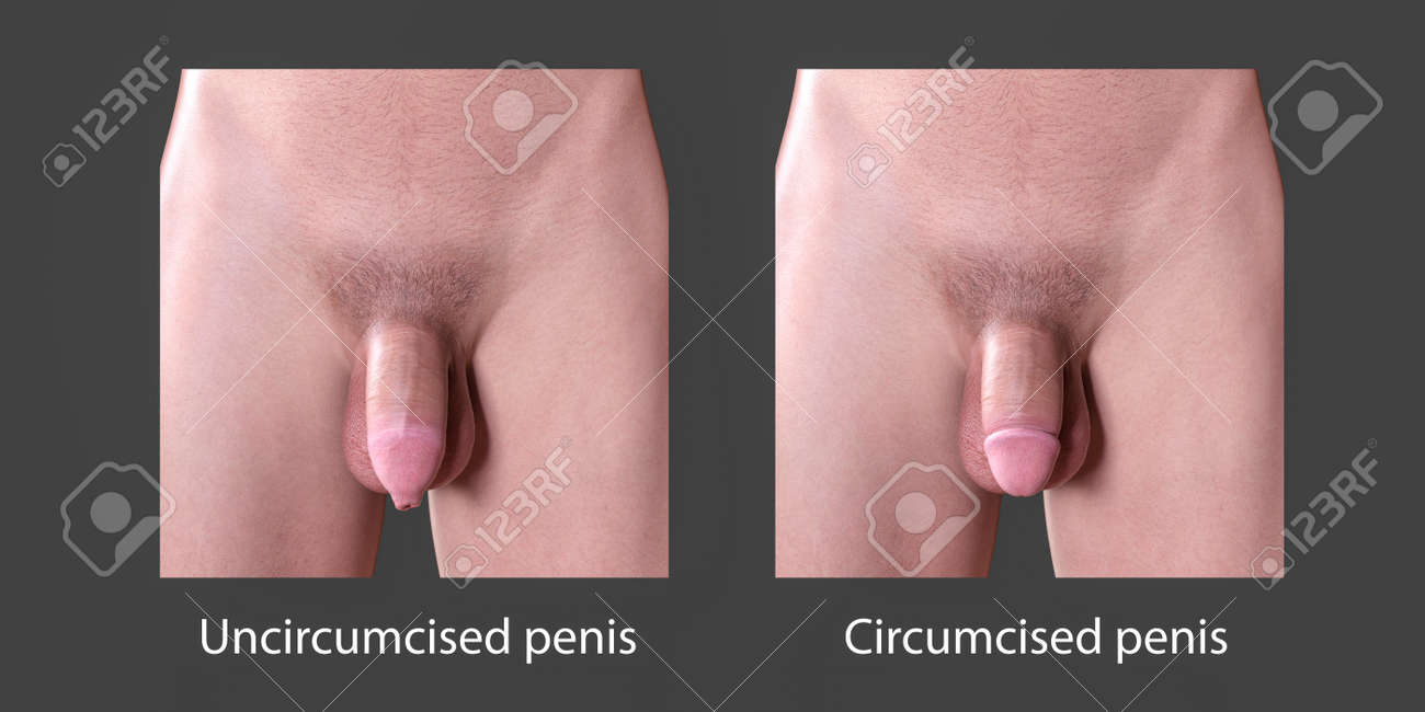 donna outland recommends uncircumcised penis pics pic