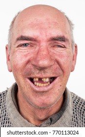 hillbilly with no teeth