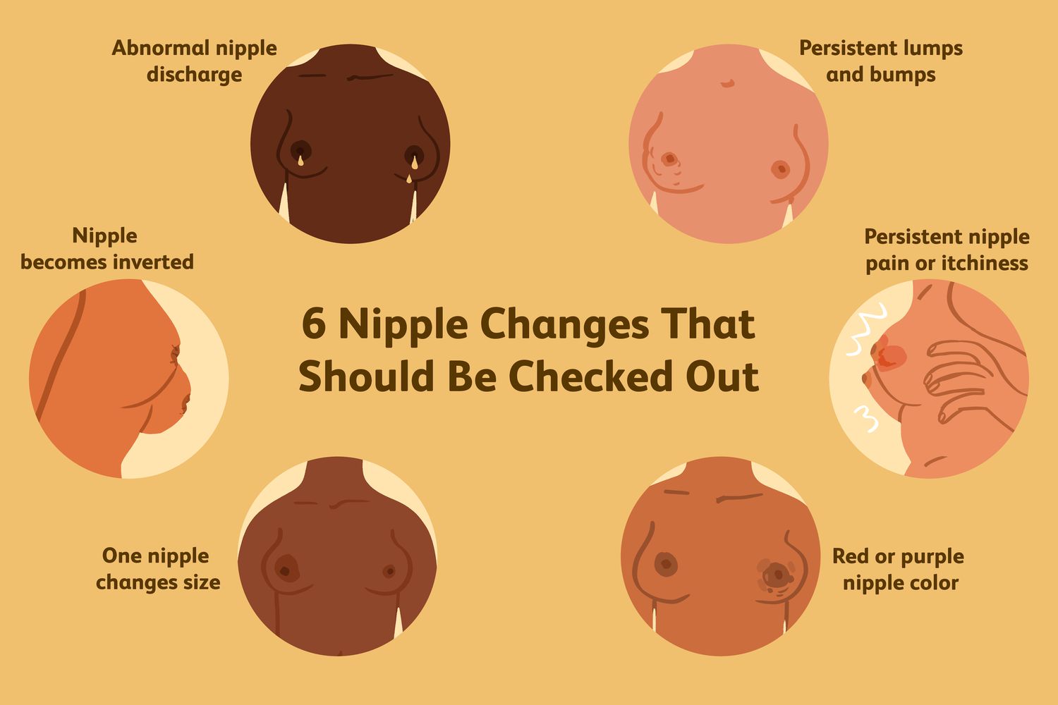 dan mullen recommends Are Large Areolas Normal