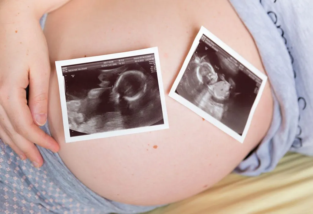 asxetos poly asxetos share positions to conceive twins photos