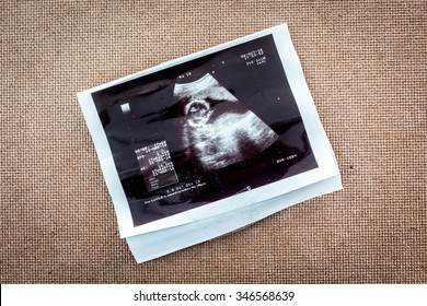 arti agrawal share fake ultrasound pics free photos