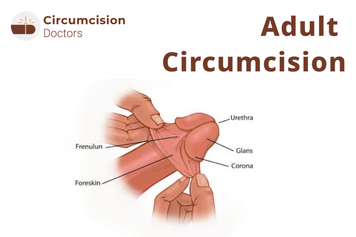 clive ceps add pictures of circumcised photo