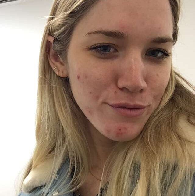 catie lynn recommends amateur facial selfie pic