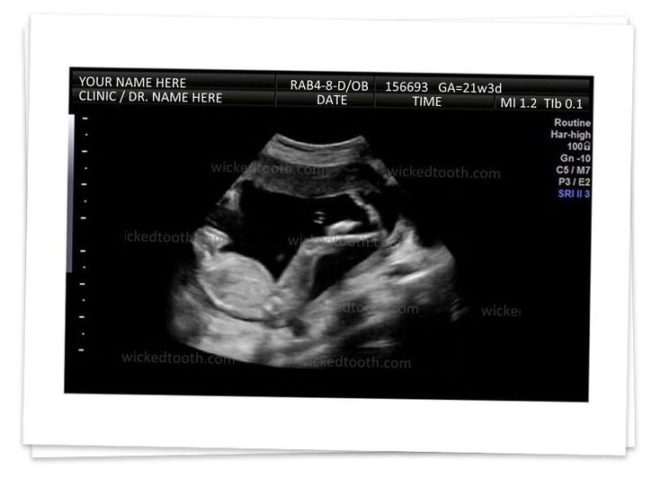 don seki recommends fake ultrasound pics free pic