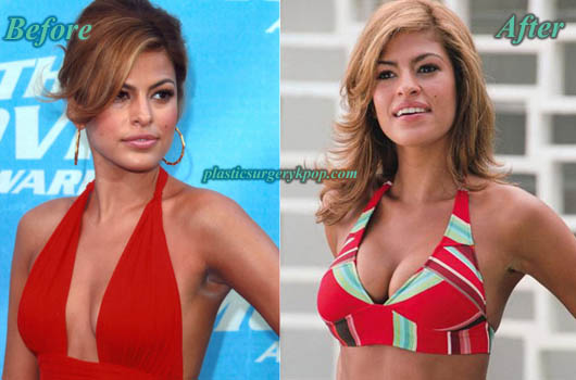 ahmed altememy recommends eva mendes boob job pic