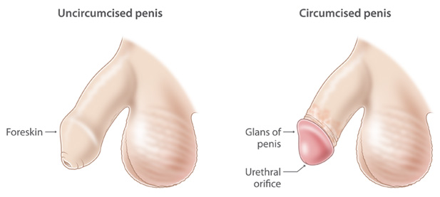 pictures of circumcised