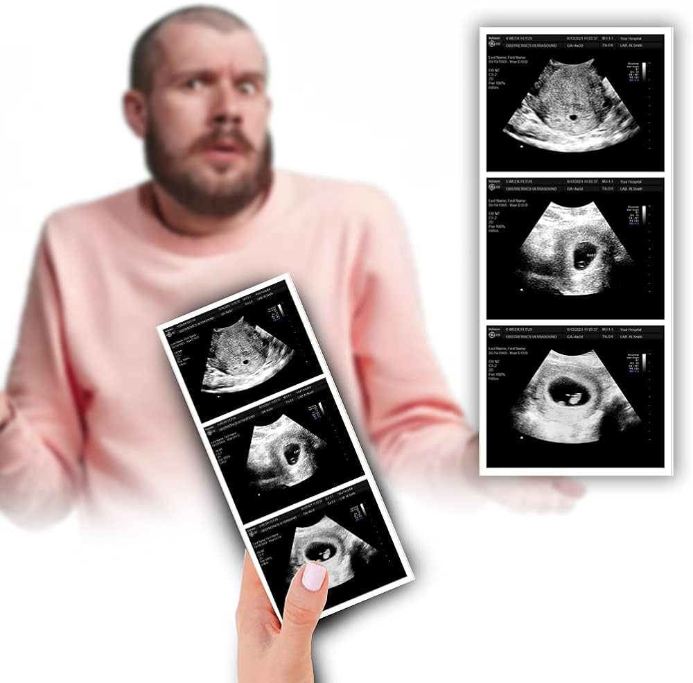 chris rozier recommends Fake Ultrasound Pics Free