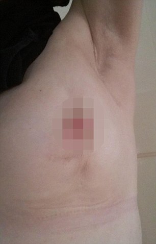 clayton honeycutt recommends nipple sinks in when lying down pic