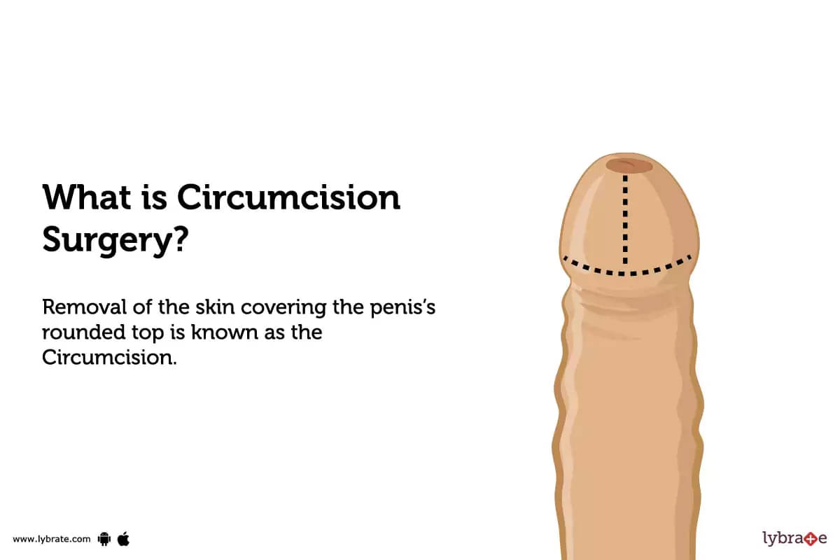 alex ruffini recommends pictures of circumcised pic