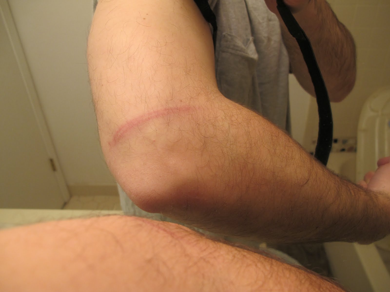 clint carrier recommends Jump Rope Whip Marks