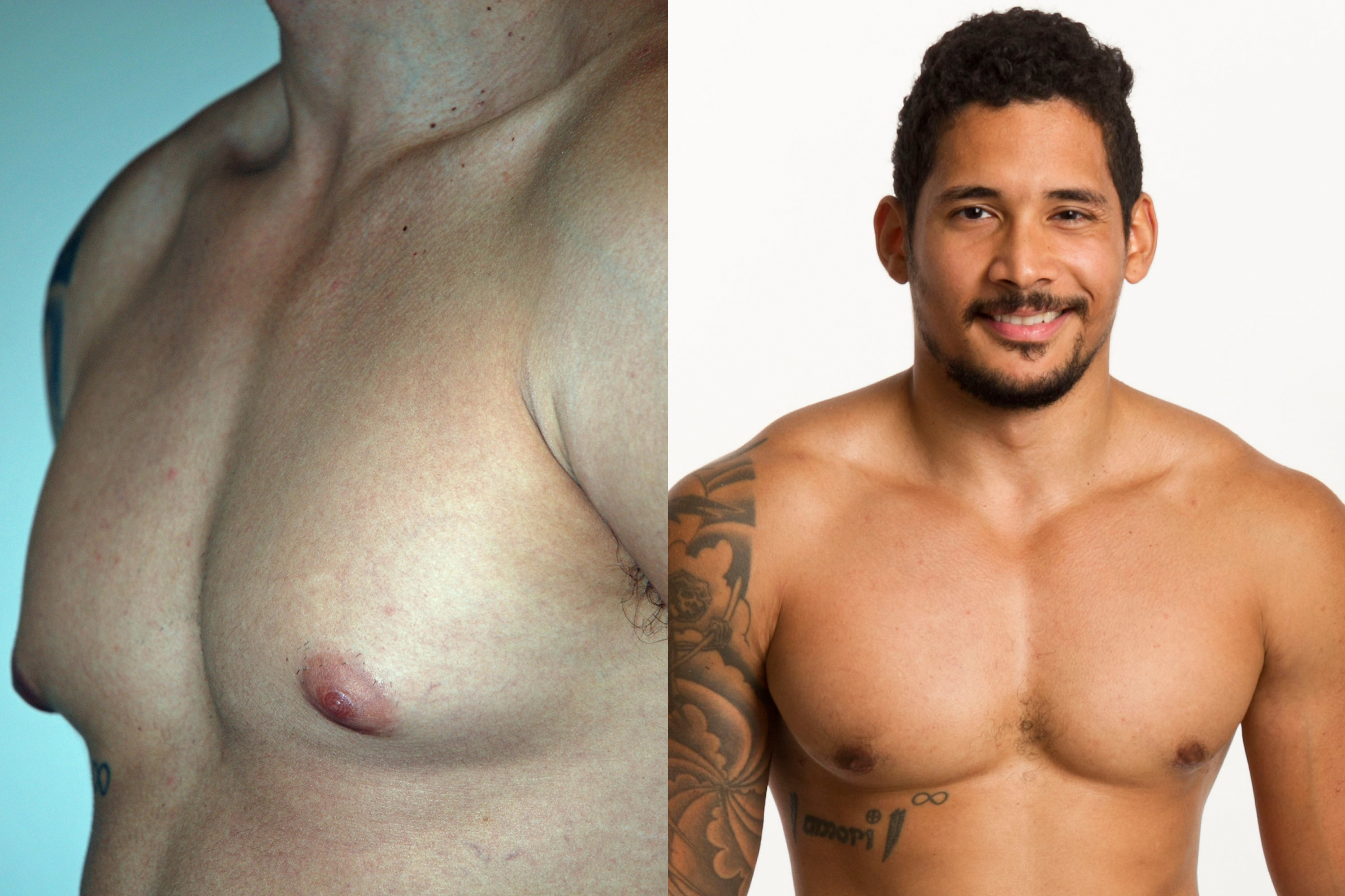 daniel herwitt recommends Dudes With Big Nipples