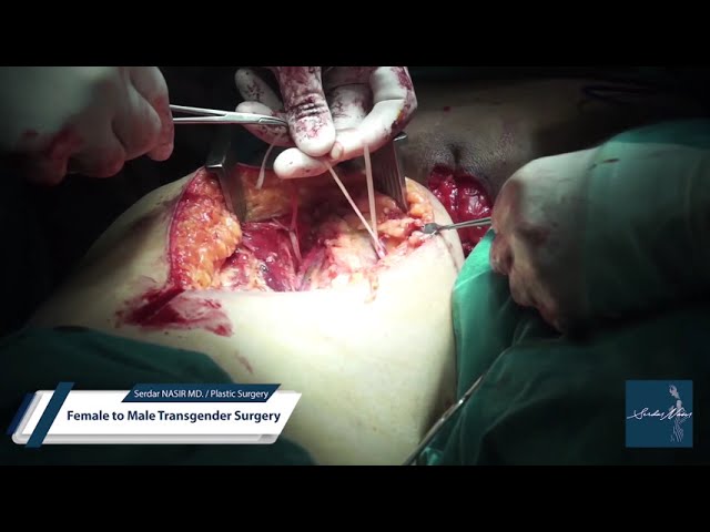 analyn yoo add photo female to male surgery full video