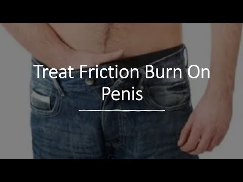 derek totin recommends Friction Burn On Penile