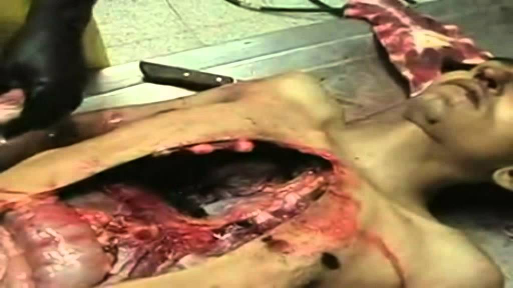 dewayne wilder recommends video de autopsia reales pic