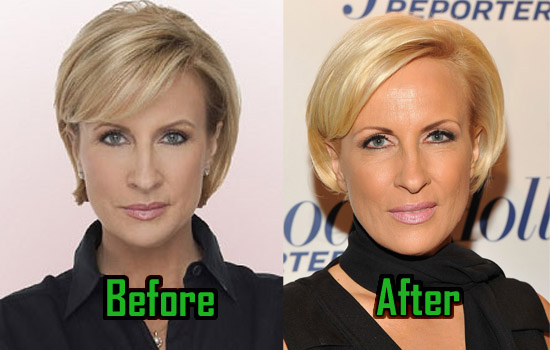 mika brzezinski boob job