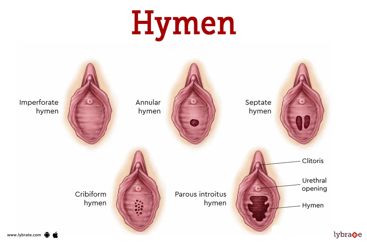 Best of Picture of hymen