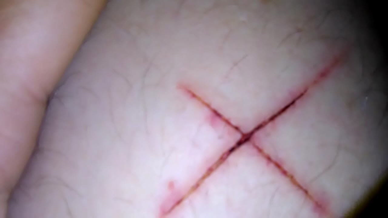 ashley shepard share self harm porn photos