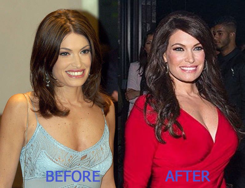 casey correia add kimberly guilfoyle tits photo