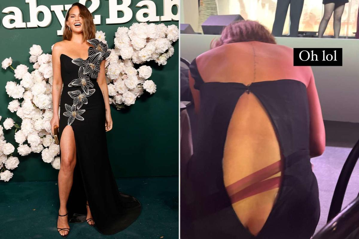 chrissy teigen wardrobe malfunction nsfw pics