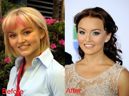 claudia ostrowski share angelique boyer boob job photos