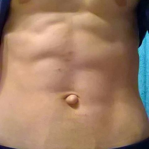 dennis ferdinand add ugly outie belly button photo