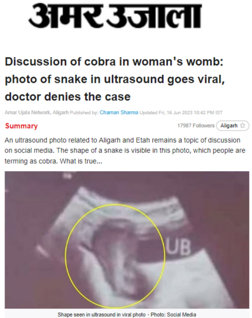 Snake In Girls Vagina image fap