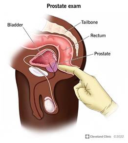 Best of Ejaculating during prostate exam