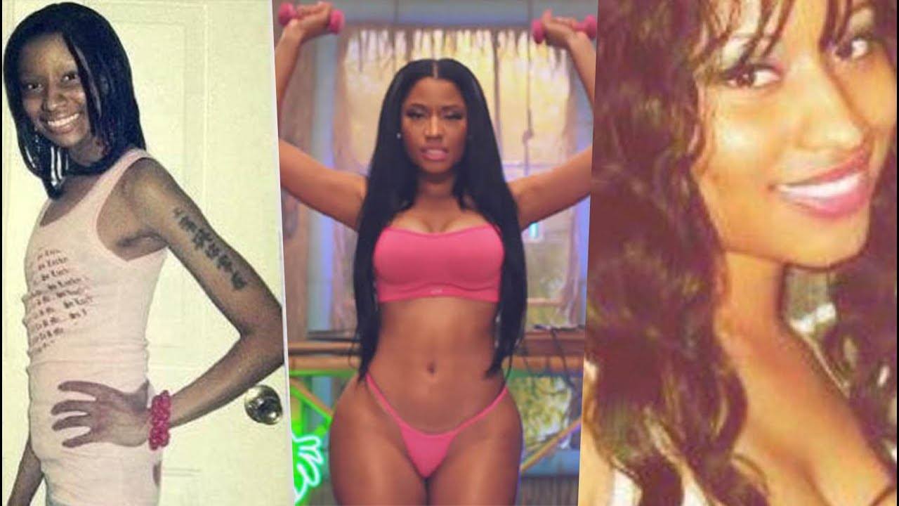 adam chiles recommends nicki minaj antes y despues pic