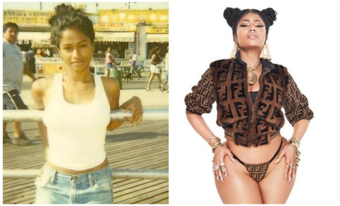 Nicki Minaj Antes Y Despues individual kolkata