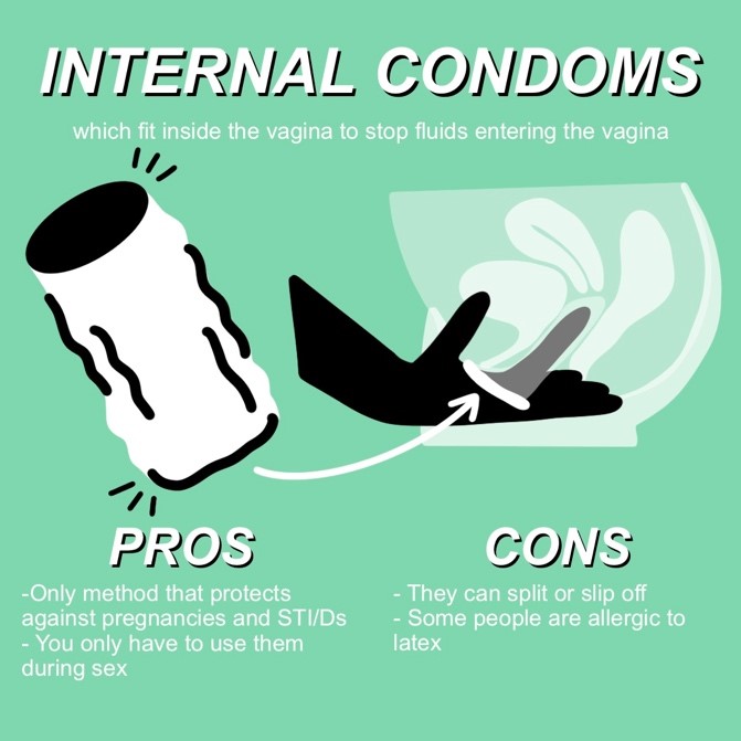 anthony bacor share condom slip off hiv photos