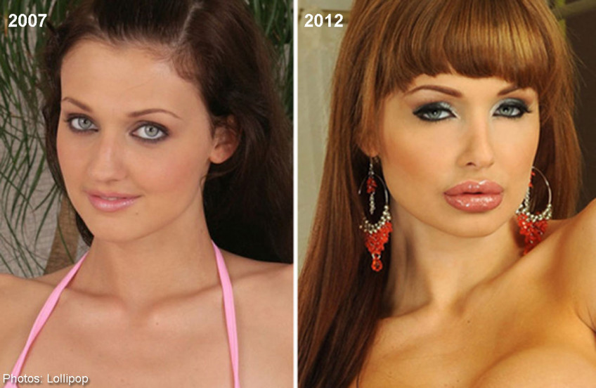 Best of Aletta ocean before and after