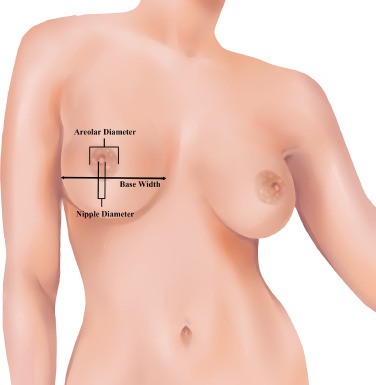 david e zimmerman recommends are large areolas normal pic