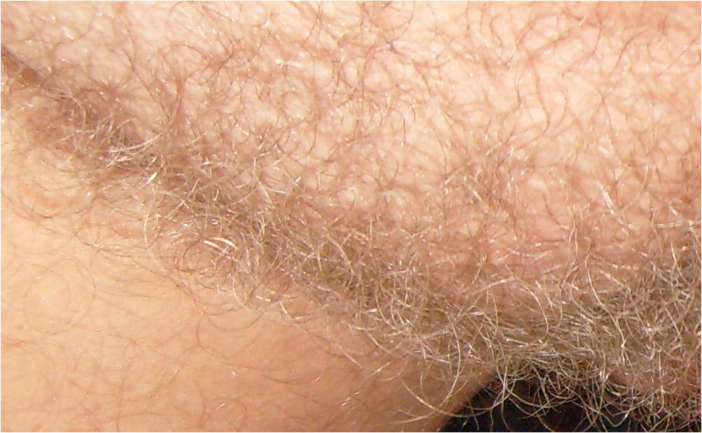 alyssa olson recommends blonde pubic hair pic