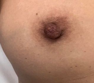 carlee hartley recommends breast nipple pic pic