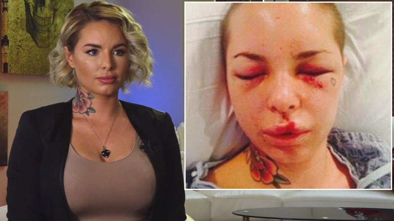 corey colton recommends christy mack new face pic