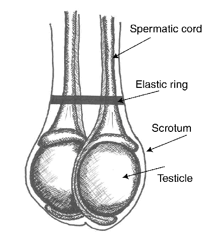 anton marniku recommends cock ring rubber band pic