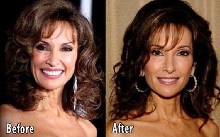 Best of Susan lucci boobs