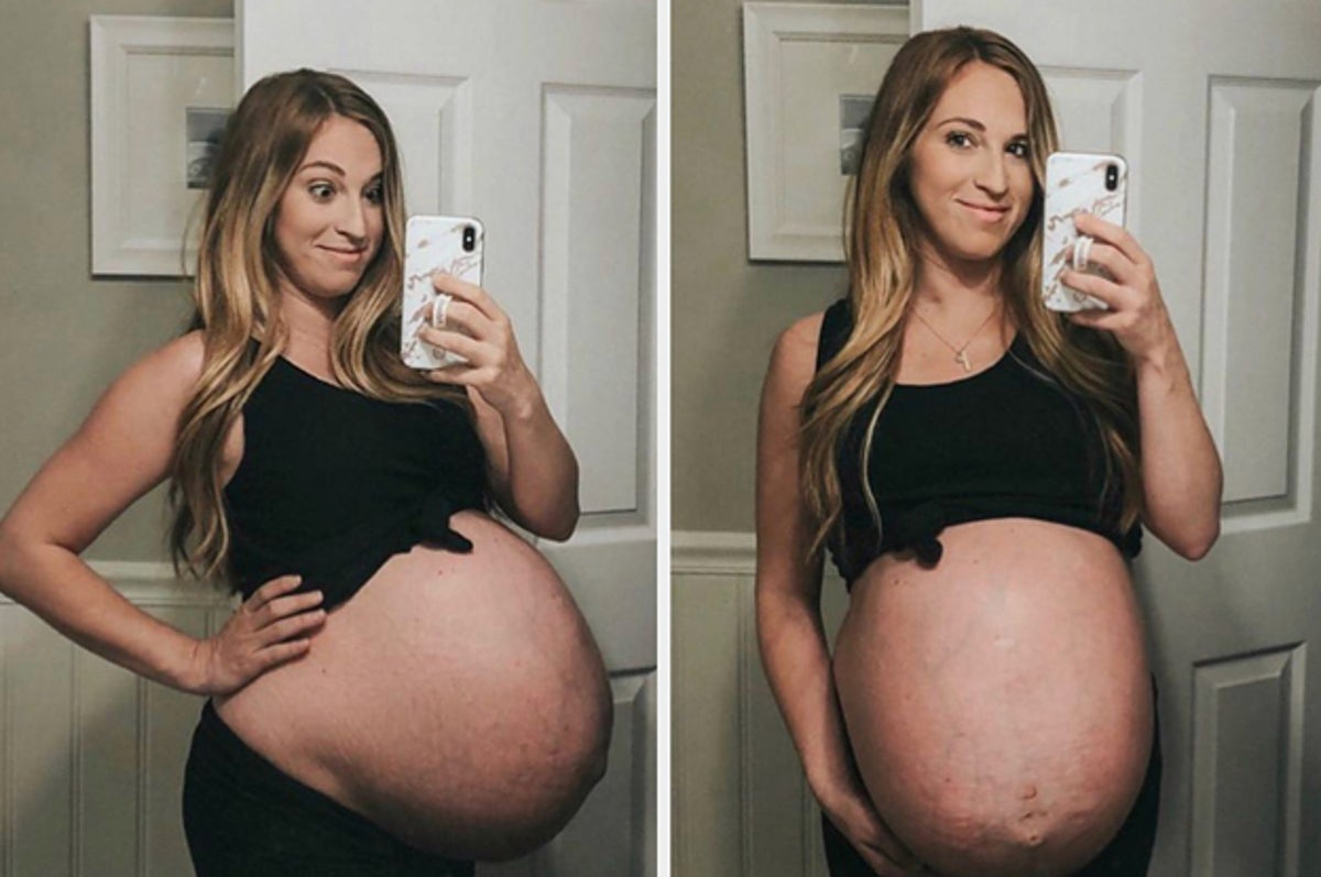 daniel thomacos recommends pregnant with quadruplets belly pic