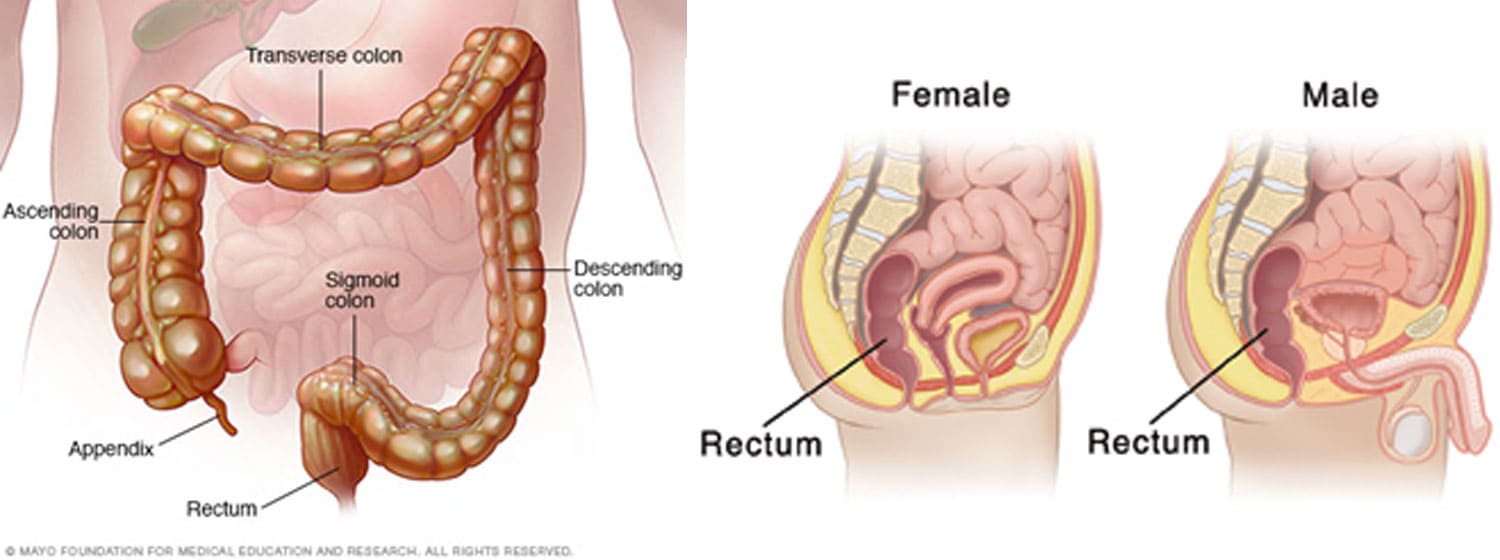 chris resseguie add diarrhea after anal sex photo