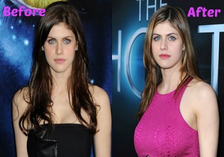 abby burt recommends does alexandra daddario have fake boobs pic