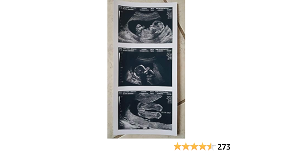 david ikin add photo fake ultrasound pics free