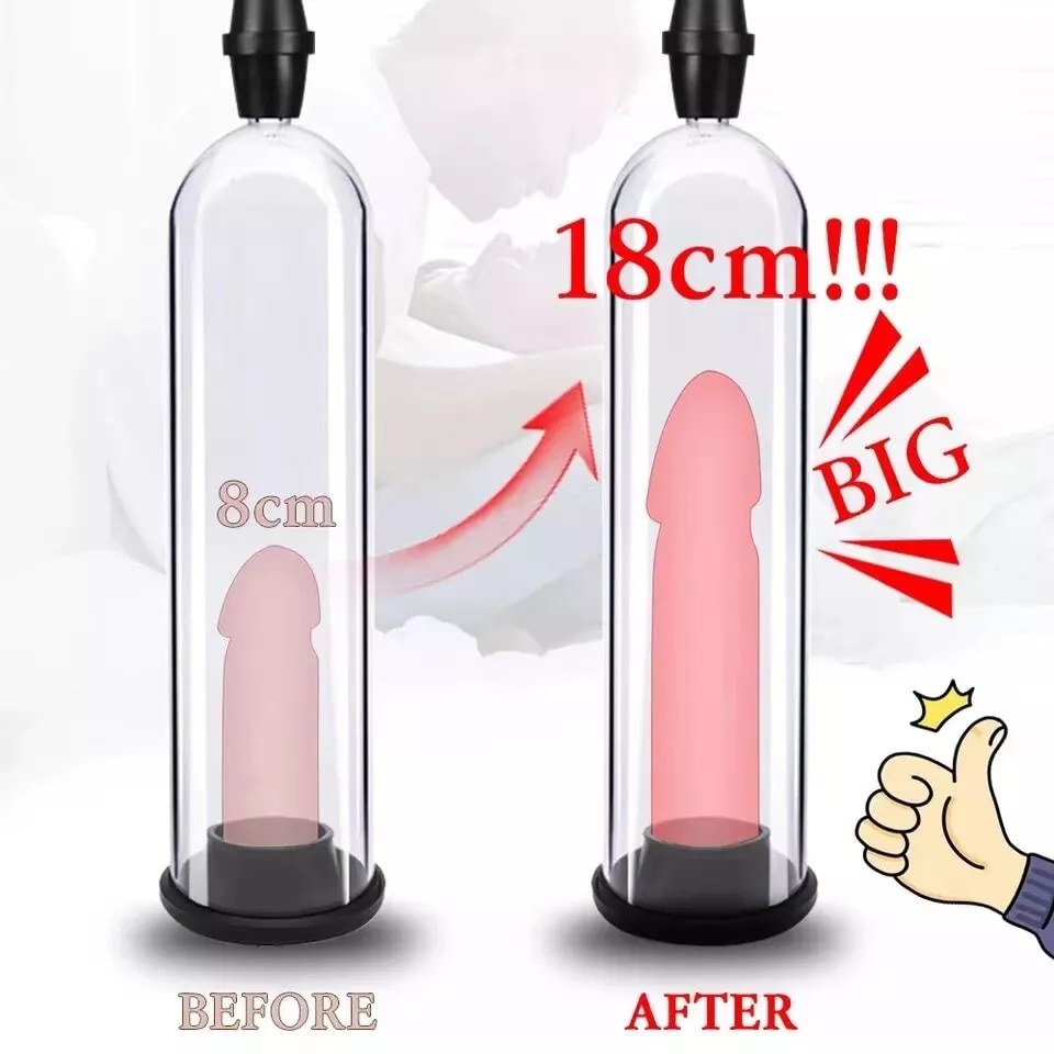 Penis Pump Before And After Pics james xxx