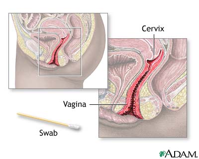 Best of Condom stuck in vagina