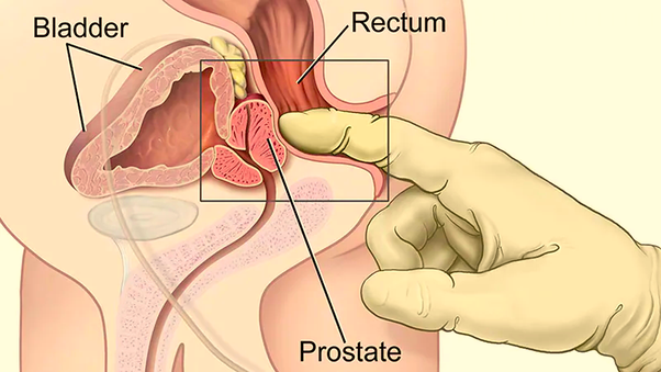 ejaculating during prostate exam