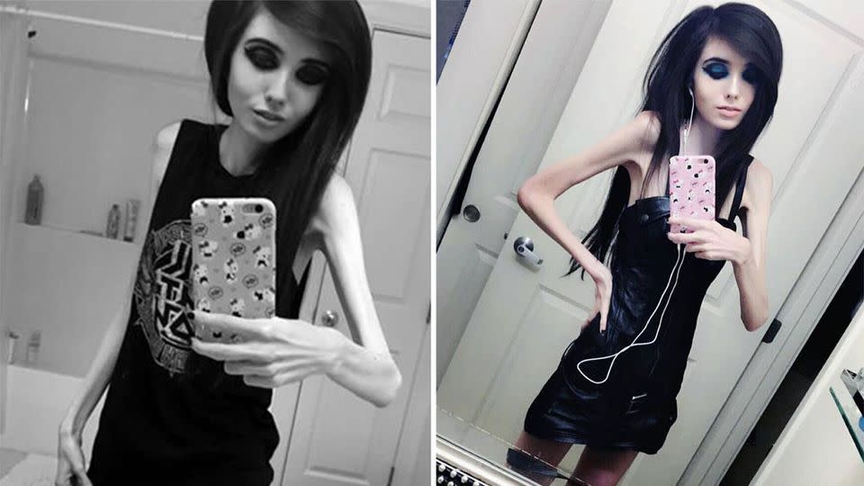 bill witherspoon share eugenia cooney vagina photos