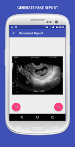 ajanta paul recommends fake ultrasound pics free pic