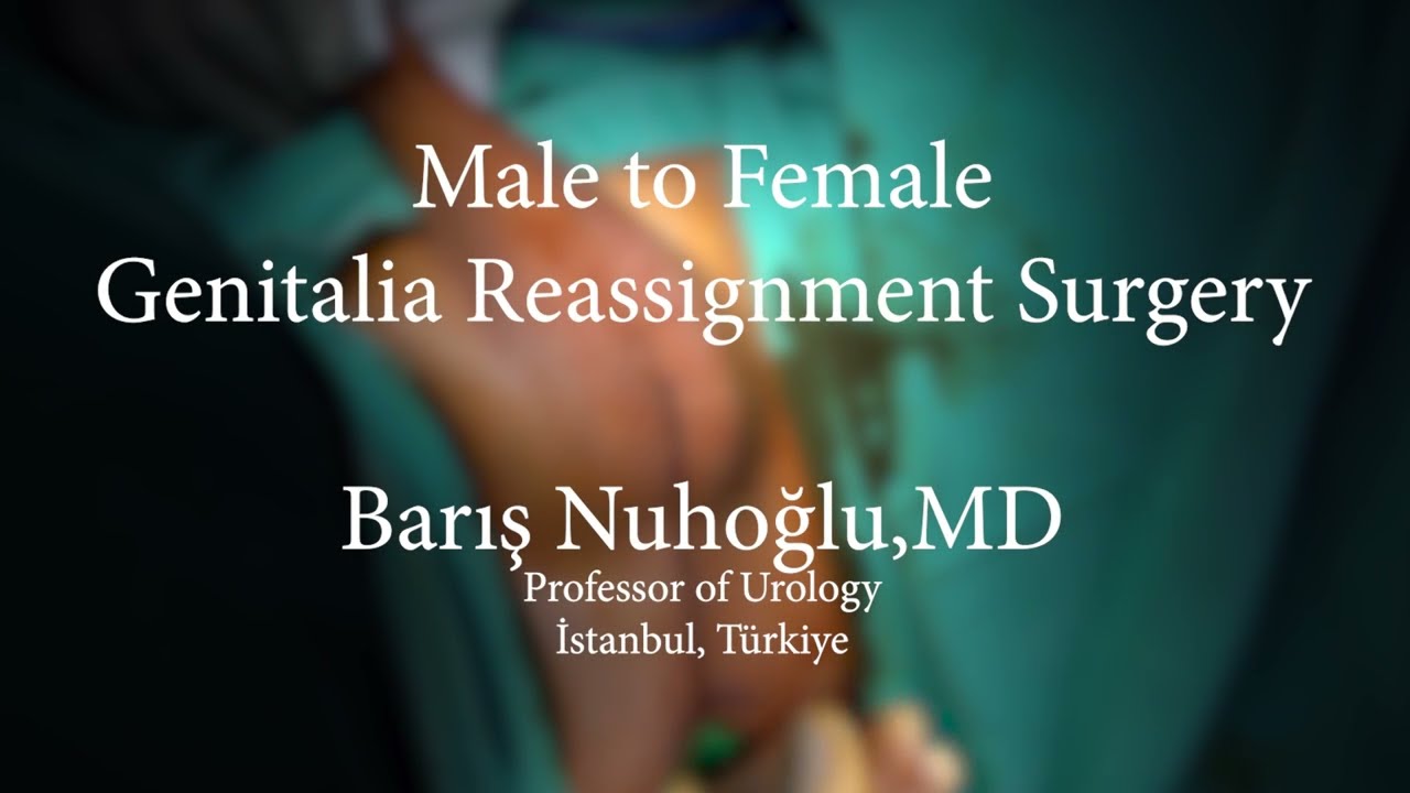 david fulbright recommends Female To Male Surgery Full Video