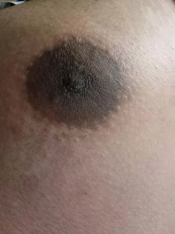 caleb prentice recommends hairy nipple photos pic