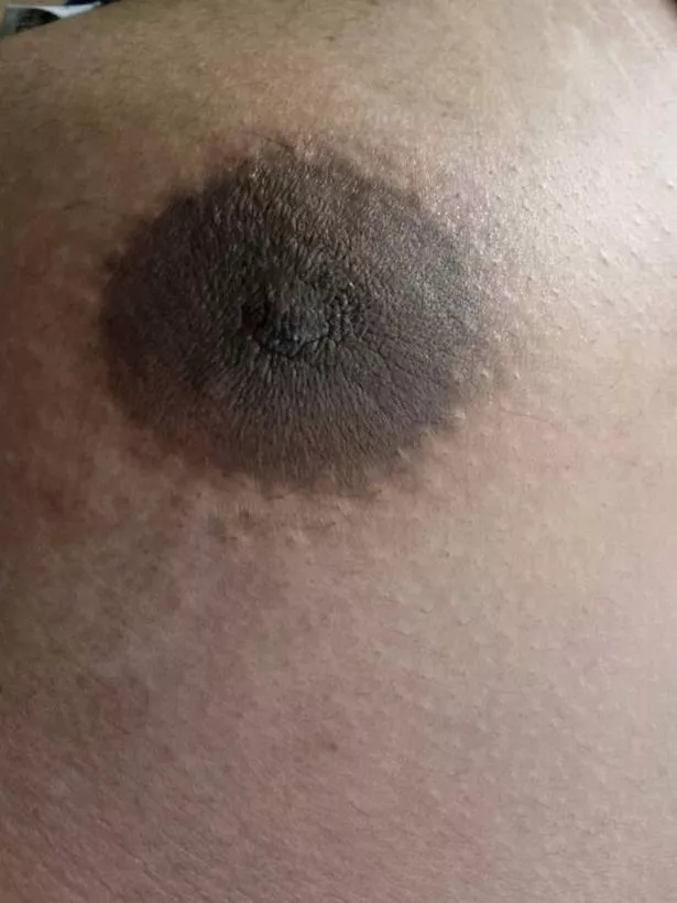 hairy nipples pics